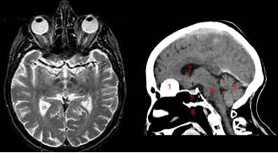 Le scanner cérébral à rayon x permet de cartographier le cerveau pour la première fois.