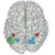 EEG du cerveau en plein calcul